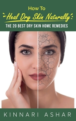 How to Heal Dry Skin Naturally: The 20 Best Dry Skin Home Remedies by Ashar, Kinnari