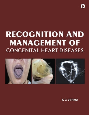 Recognition and Management of Congenital Heart Diseases by K C Verma