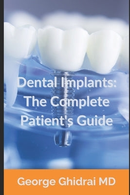Dental Implants: The Complete Patient's Guide by Ghidrai, George