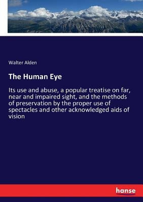 The Human Eye: Its use and abuse, a popular treatise on far, near and impaired sight, and the methods of preservation by the proper use of spectacles by Alden, Walter