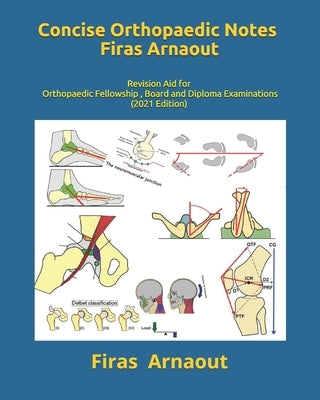 Concise Orthopaedic Notes: Revision aid for FRCS, EBOT , SICOT and Board Examinations by Arnaout Frcs, Firas