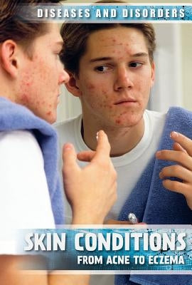Skin Conditions: From Acne to Eczema by Reynolds, Donna