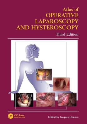 Atlas of Operative Laparoscopy and Hysteroscopy by Donnez, Jacques