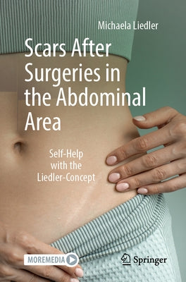 Scars After Surgeries in the Abdominal Area: Self-Help with the Liedler-Concept by Liedler, Michaela