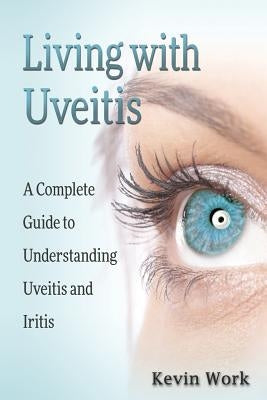 Living with Uveitis: A Complete Guide to Uveitis and Iritis by Work, Kevin