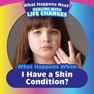 What Happens When I Have a Skin Condition? by King, Emiliya