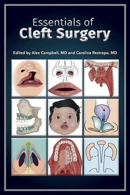 Essentials of Cleft Surgery: Volume 1 by Campbell, Alex