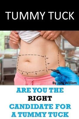 Tummy Tuck: Are You The Right Candidate For A Tummy Tuck by William, Tony