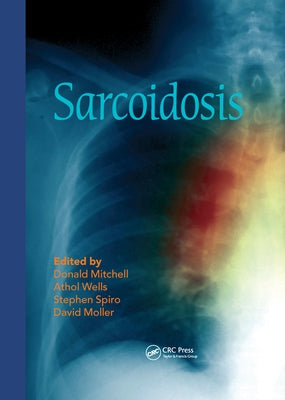 Sarcoidosis by Mitchell, Donald