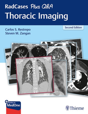 Radcases Plus Q&A Thoracic Imaging by Restrepo, Carlos S.