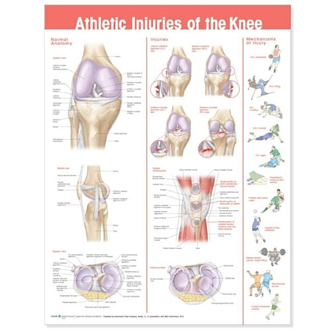 Athletic Injuries of the Knee Anatomical Chart by Anatomical Chart Company