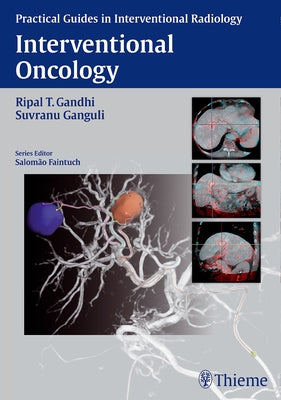 Interventional Oncology by Gandhi, Ripal