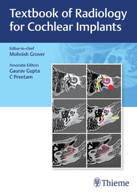 Textbook of Radiology for Cochlear Implants by Grover, Mohnish