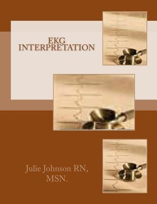 EKG Interpretation by Johnson Rn, Msn Julie