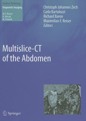 Multislice-CT of the Abdomen by Zech, Christoph Johannes