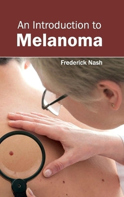 Introduction to Melanoma by Nash, Frederick