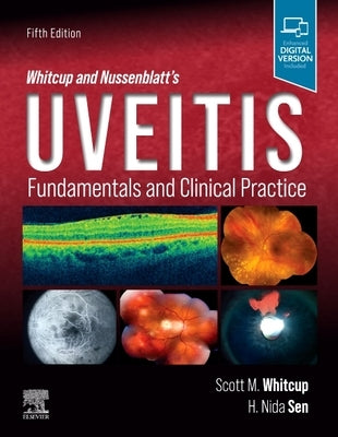 Whitcup and Nussenblatt's Uveitis: Fundamentals and Clinical Practice by Whitcup, Scott M.