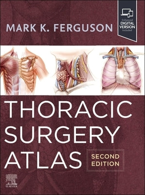 Thoracic Surgery Atlas by Ferguson, Mark K.