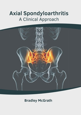 Axial Spondyloarthritis: A Clinical Approach by McGrath, Bradley