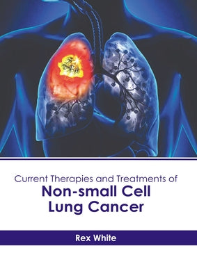 Current Therapies and Treatments of Non-Small Cell Lung Cancer by White, Rex