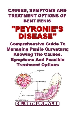 Causes, Symptoms and Treatment Options of Bent Penis "Peyronie's Disease": Comprehensive Guide To Managing Penile Curvature; Knowing The Causes, Sympt by Myles, Arthur