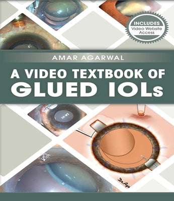 A Video Textbook of Glued IOLs by Agarwal, Amar