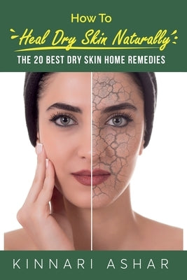 How to Heal Dry Skin Naturally: The 20 Best Dry Skin Home Remedies by Ashar, Kinnari