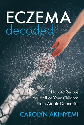 Eczema Decoded: How to Rescue Yourself or Your Children from Atopic Dermatitis by Akinyemi, Carolyn