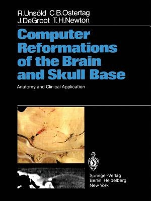 Computer Reformations of the Brain and Skull Base: Anatomy and Clinical Application by Unsöld, R.
