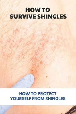 How To Survive Shingles: How To Protect Yourself From Shingles: How To Speed Up Shingles Recovery by Rehder, Marisha