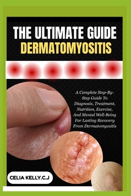 The Ultimate Guide Dermatomyositis: A Complete Step-By-Step Guide To Diagnosis, Treatment, Nutrition, Exercise, And Mental Well-Being For Lasting Reco by Kelly C. J., Celia