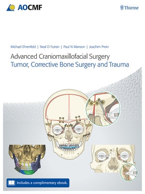Advanced Craniomaxillofacial Surgery: Tumor, Corrective Bone Surgery, and Trauma by Ehrenfeld, Michael
