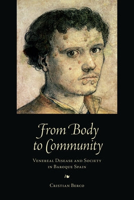 From Body to Community: Venereal Disease and Society in Baroque Spain by Berco, Cristian