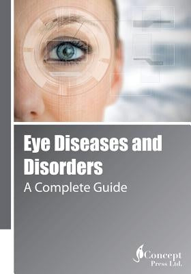 Eye Diseases and Disorders: A Complete Guide by Press, Iconcept