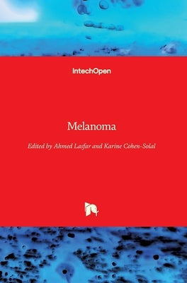 Melanoma by Lasfar, Ahmed