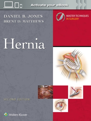 Master Techniques in Surgery: Hernia: Print + eBook with Multimedia by Jones, Daniel B.