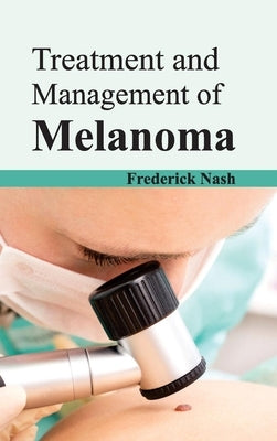 Treatment and Management of Melanoma by Nash, Frederick