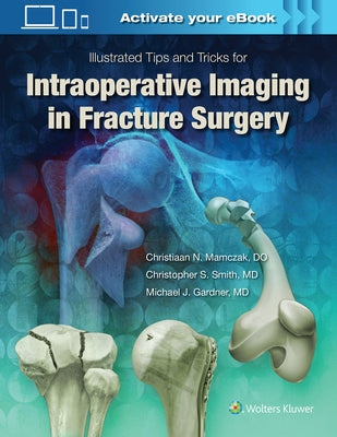 Illustrated Tips and Tricks for Intraoperative Imaging in Fracture Surgery by Gardner, Michael J.