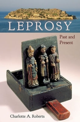 Leprosy: Past and Present by Roberts, Charlotte A.