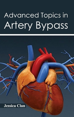 Advanced Topics in Artery Bypass by Clan, Jessica