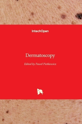 Dermatoscopy by Pietkiewicz, Pawel