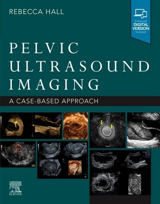 Pelvic Ultrasound Imaging: A Cased-Based Approach by Hall, Rebecca