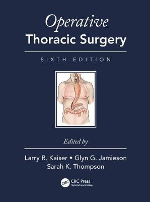 Operative Thoracic Surgery by Kaiser, Larry R.