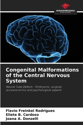 Congenital Malformations of the Central Nervous System by Freinkel Rodrigues, Flavio