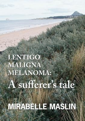 Lentigo Maligna Melanoma: A Sufferer's Tale by Maslin, Mirabelle