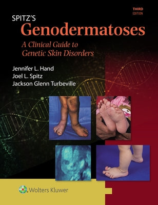 Spitz's Genodermatoses: A Full Color Clinical Guide to Genetic Skin Disorders by Spitz, Joel L.