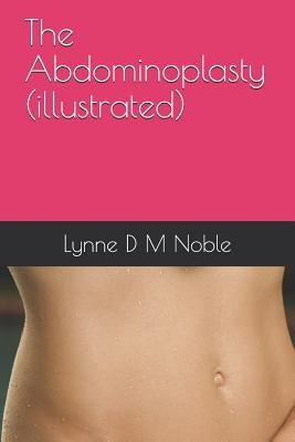 The Abdominoplasty (illustrated) by Noble, Lynne D. M.