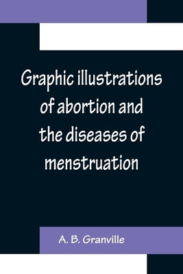 Graphic illustrations of abortion and the diseases of menstruation; Consisting of Twelve Plates from Drawings Engraved on Stone, and Coloured by Mr. J by B. Granville, A.