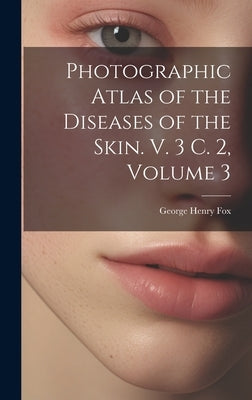 Photographic Atlas of the Diseases of the Skin. V. 3 C. 2, Volume 3 by Fox, George Henry