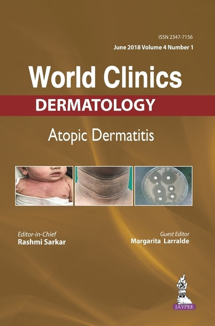 World Clinics-Atopic Dermatitis (June 2018, Vol.04 Issue 1) by Sarkar, Rashmi